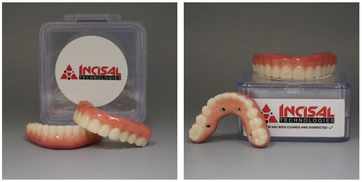 Crystal Ultra Hybrid Dentures