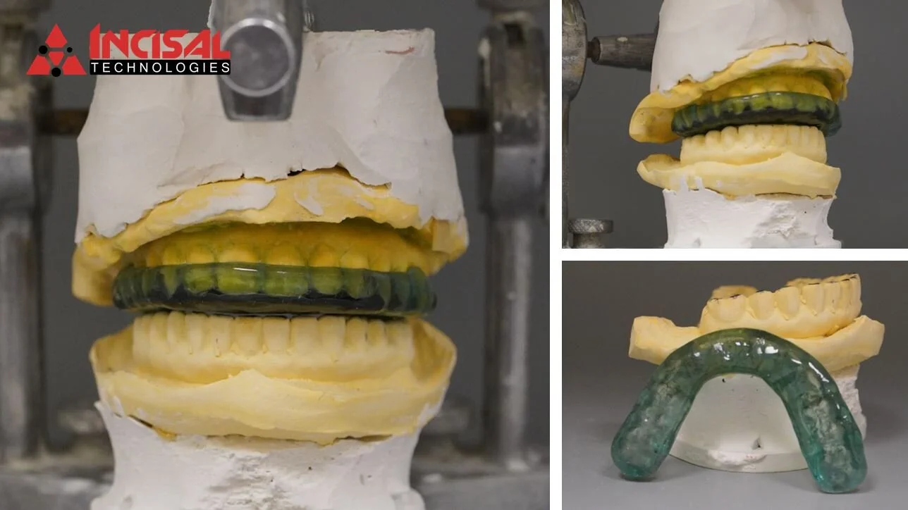 3D Printed Night Guards