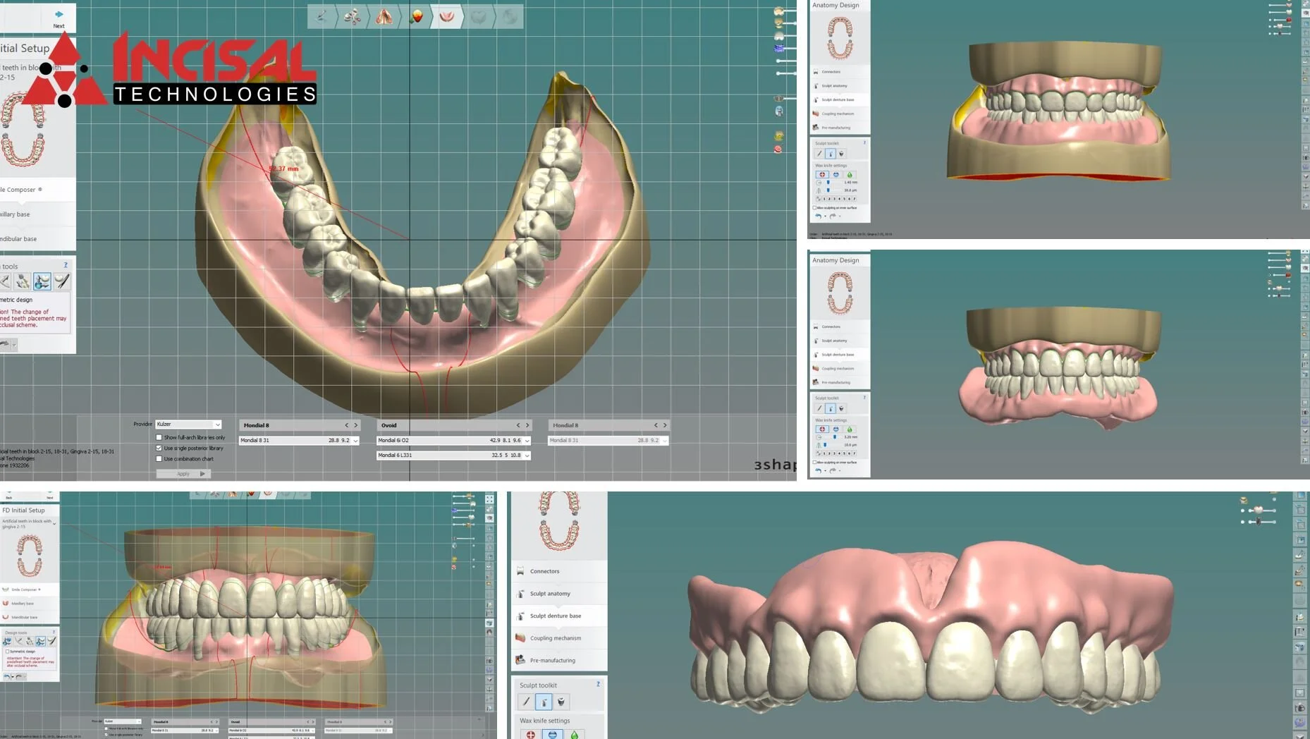 Digital Denture Design