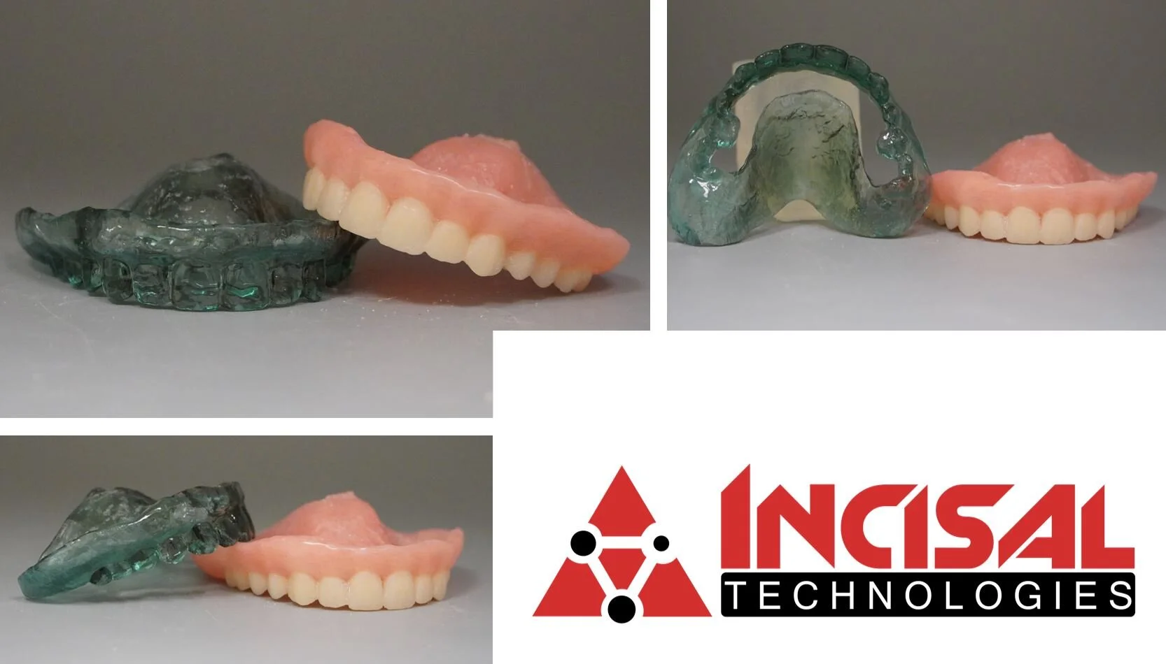 Denture and Surgical Guide