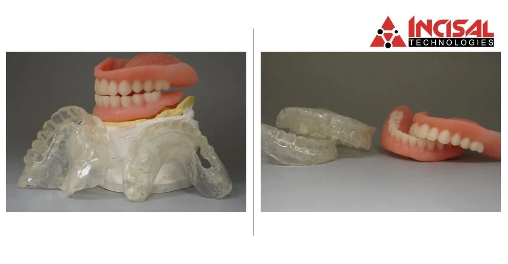 Dentures and Surgical Guides