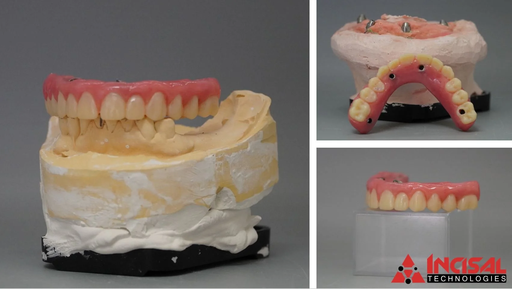 Hybrid Denture Wax Try In