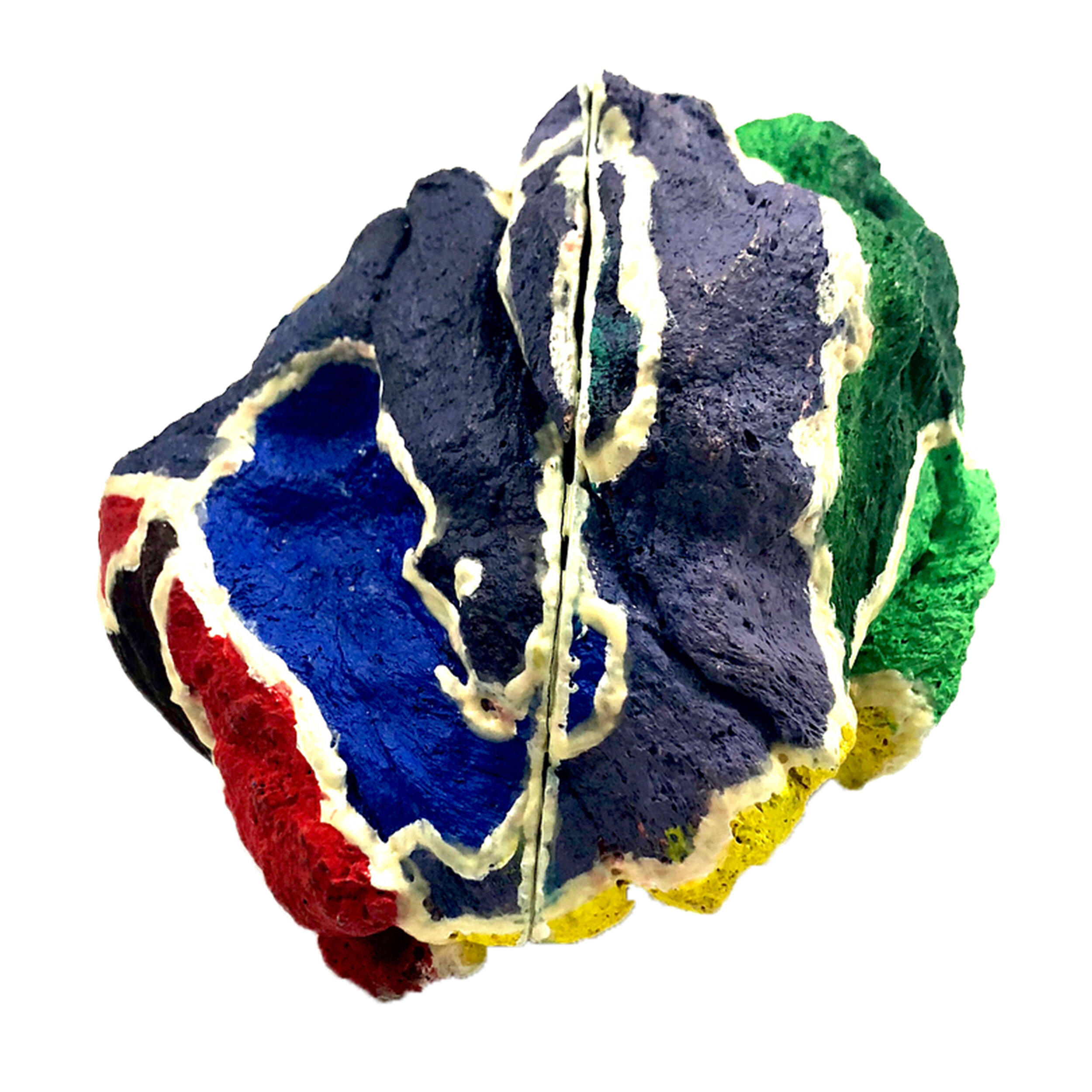 Brain Cancer