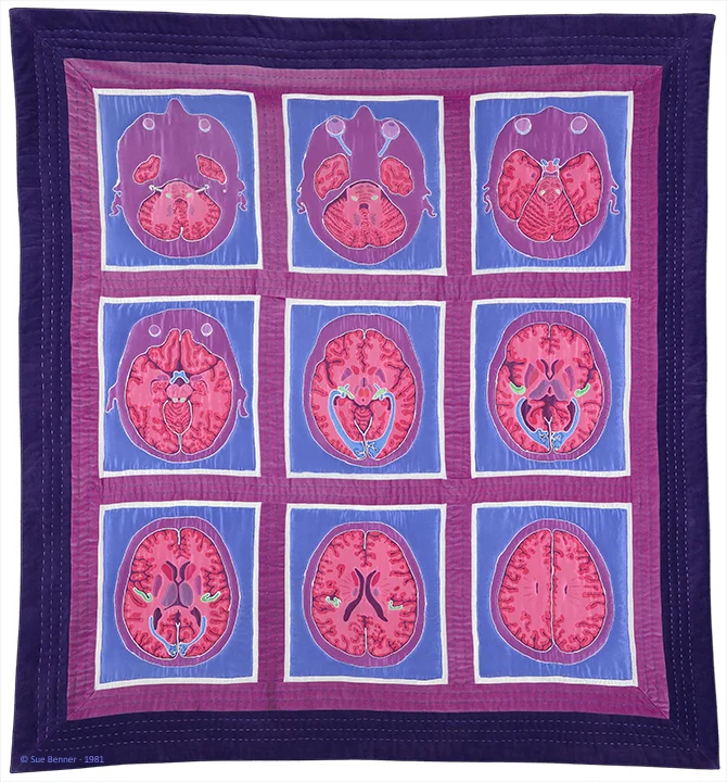 BennerSue_Brain Quilt_DetailAreducd.jpg