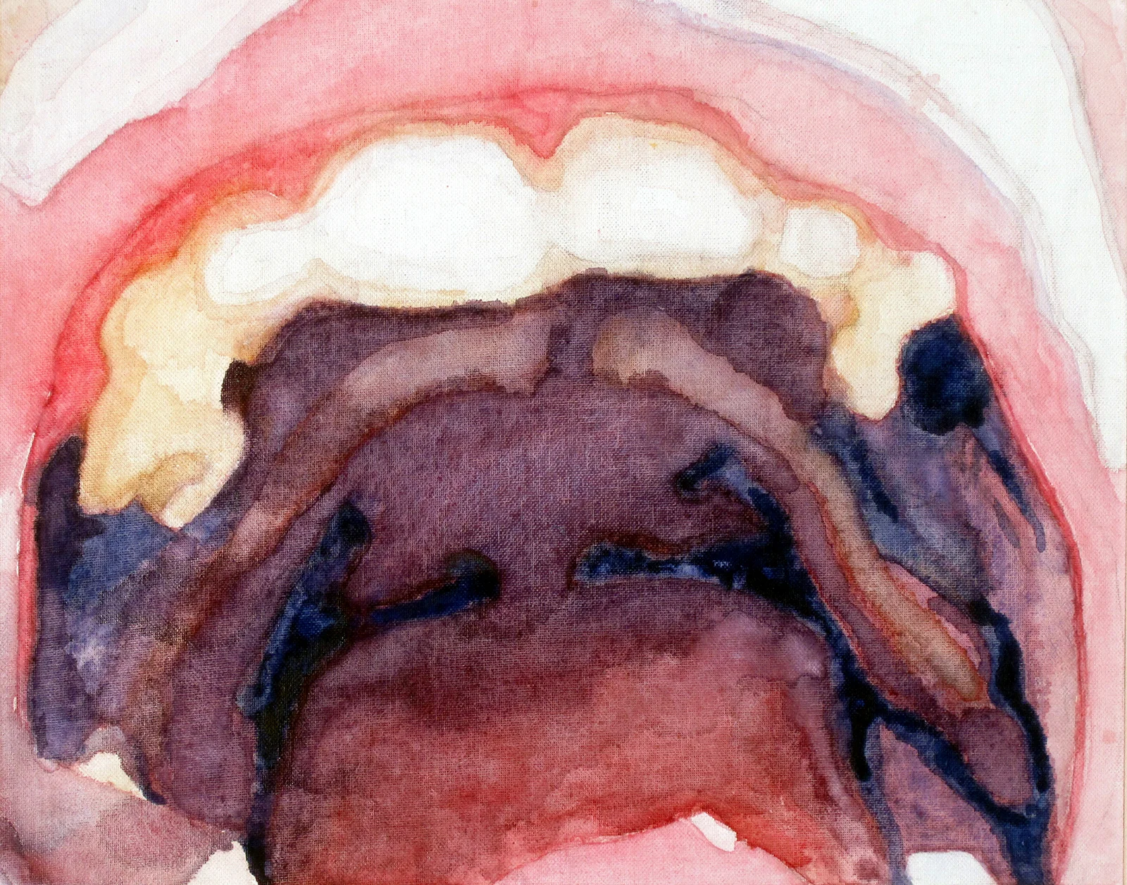 'Tonsillitis', Watercolor on Canvas Panel, 13.75'' x 17.5'', 2001