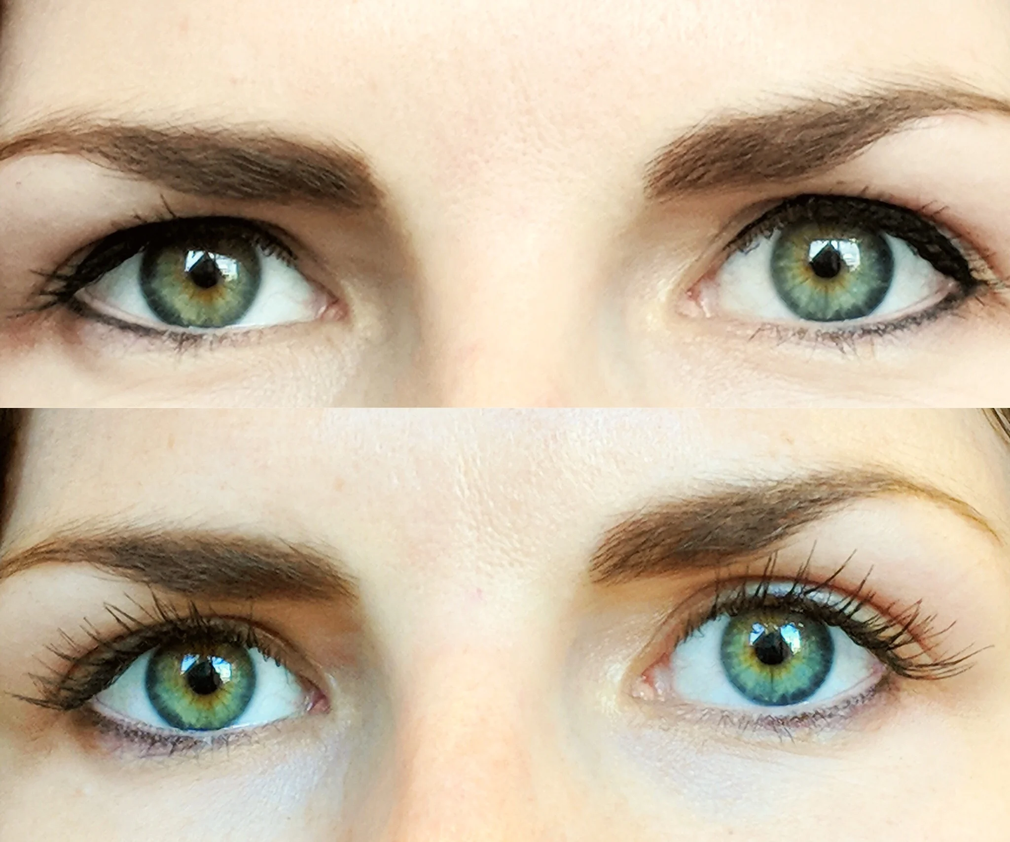 Dr.Hines before and after Latisse treatment (she does not have eyelash hypotrichosis)