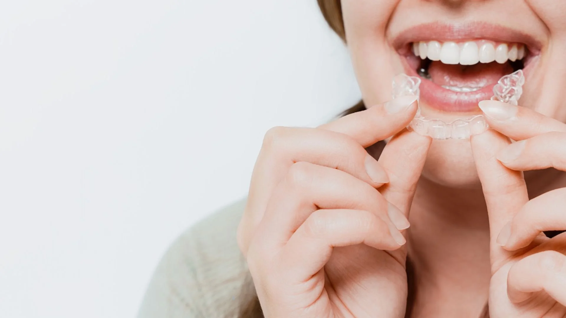 How to Keep Your Invisalign Aligners Stain-Free (1).jpg
