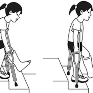 The Rat Queen-- last week's busted ankle endeavour