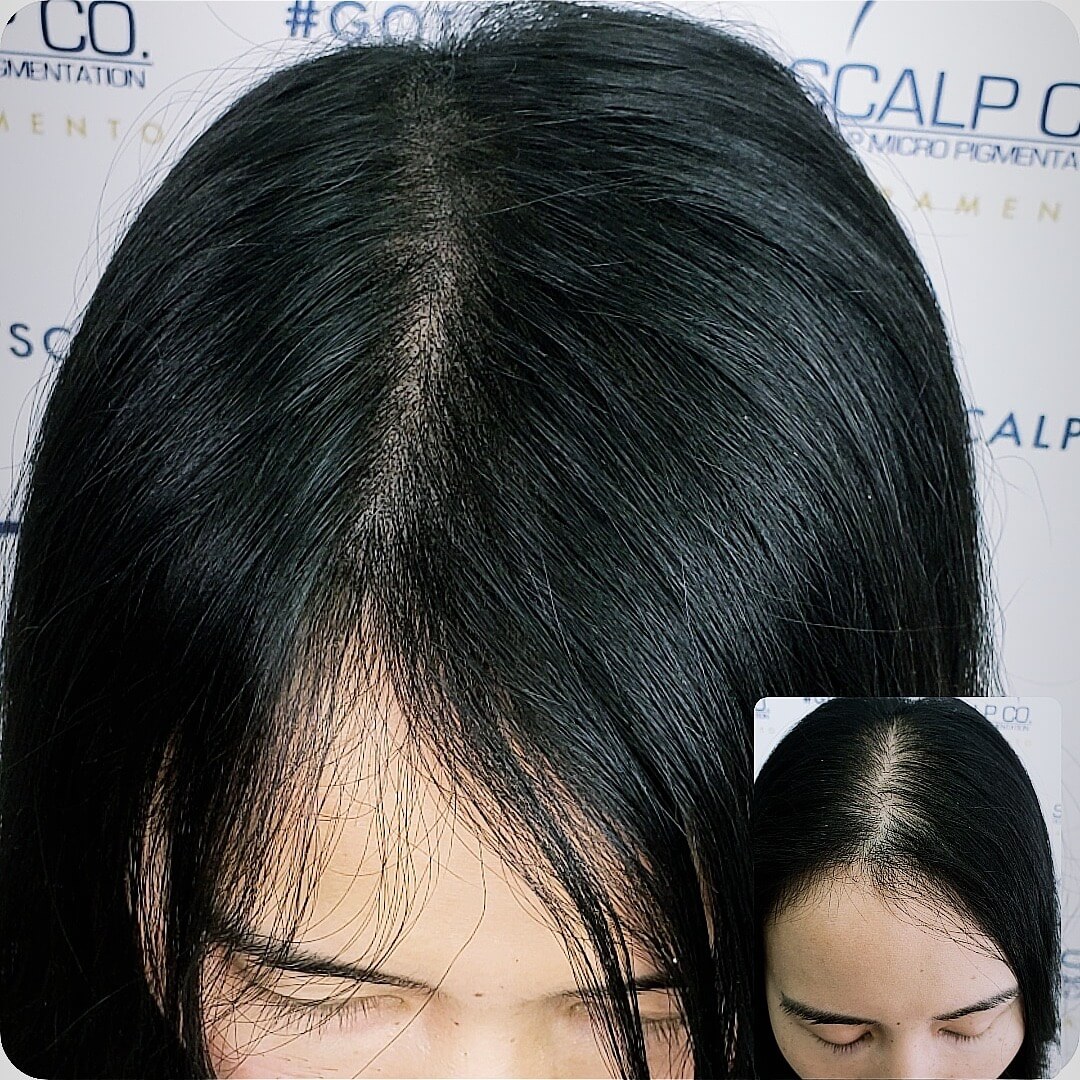 SMP scalp co female up close.JPG
