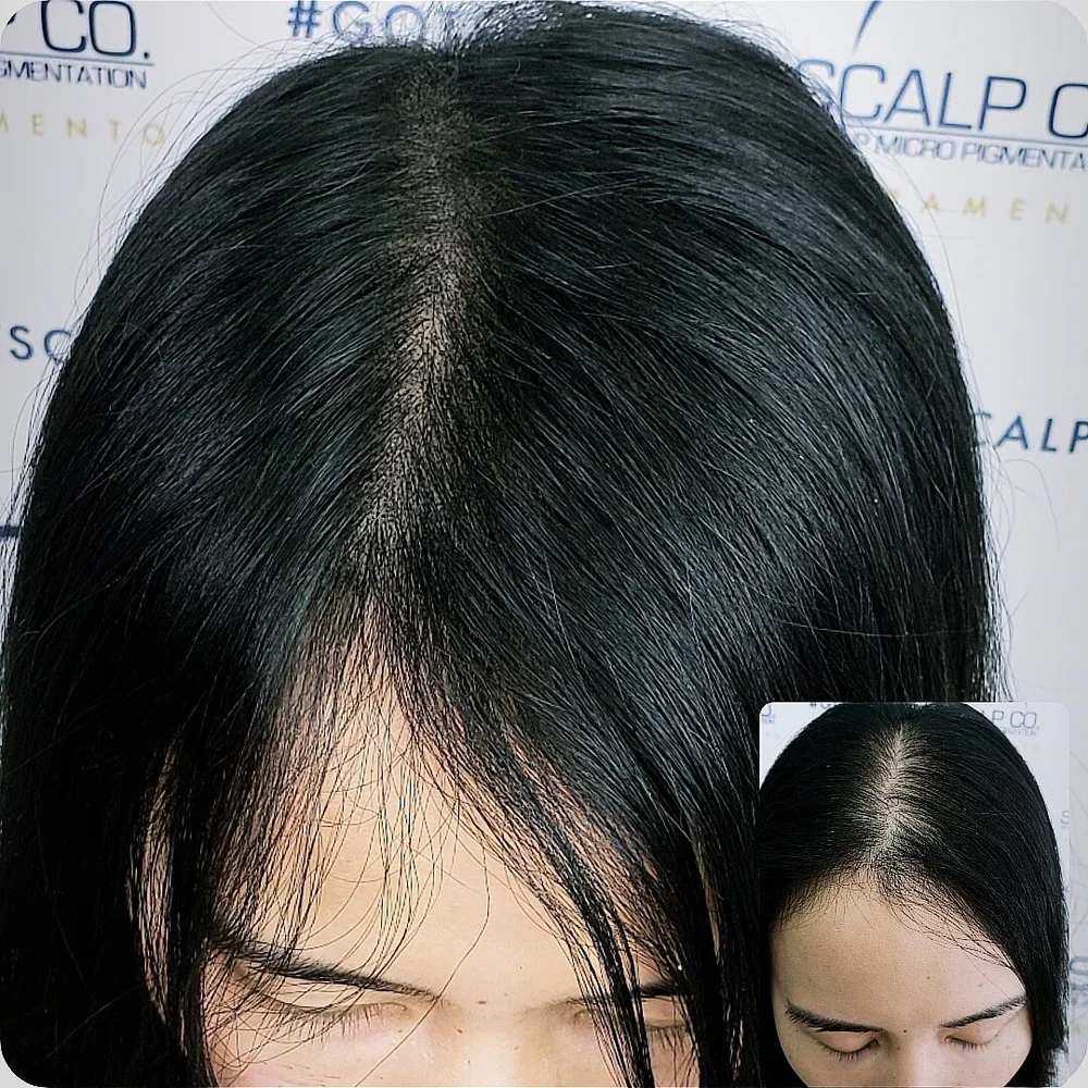 Scalp Co. female scalp density before-and-after composite