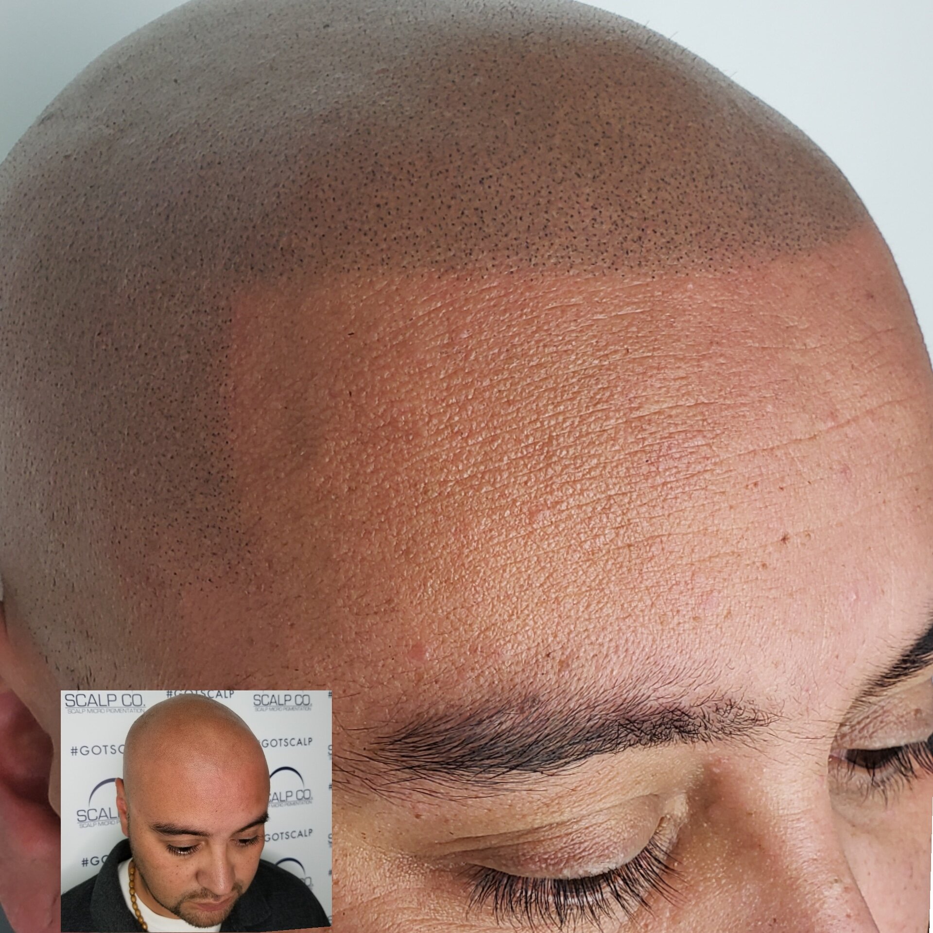 balding in the front smp fixed my bald spot.jpg