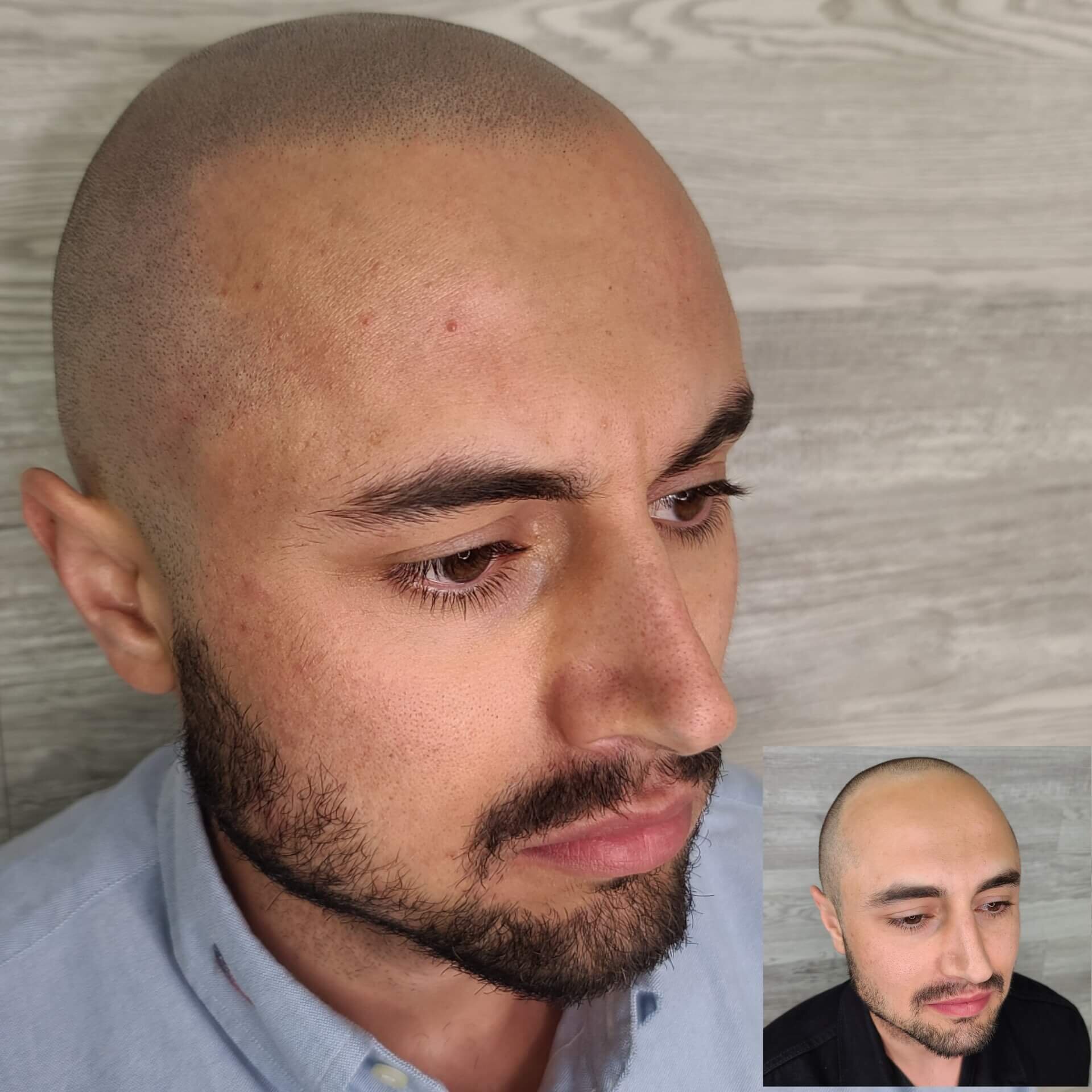 29 Classy Haircuts for Receding Hairlines - StyleSeat