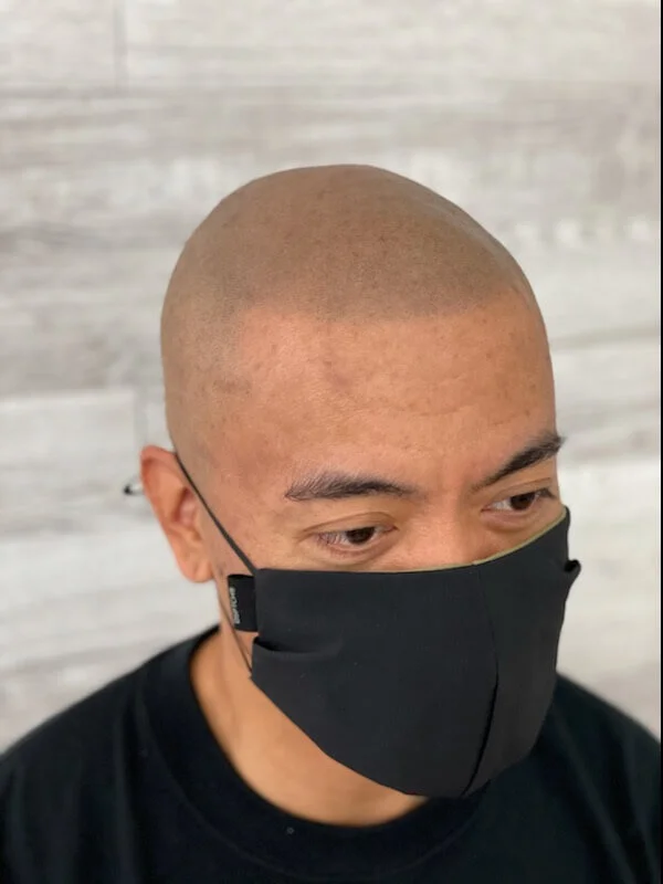 Scalp Micropigmentation Could Be a Life-Changing Process