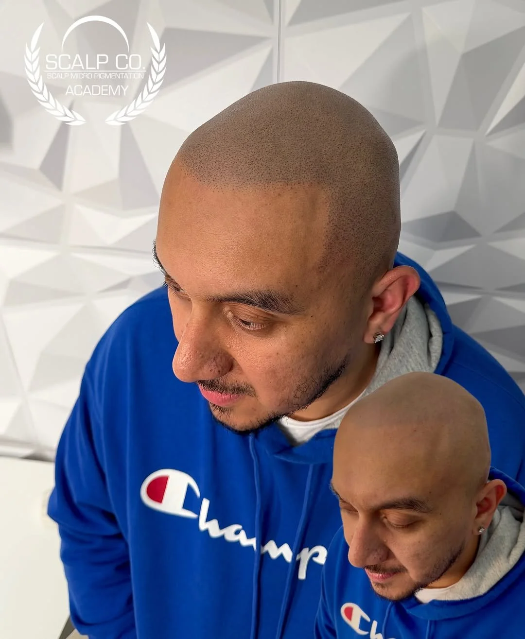 hair-tattoo-smp-before-after.jpg