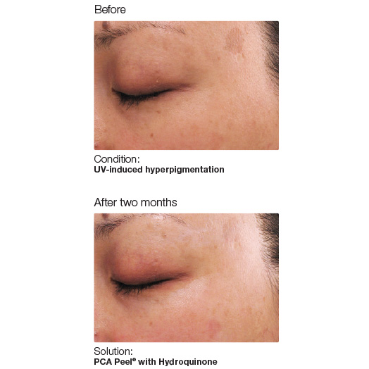 Discoloration-Image1-web.jpg