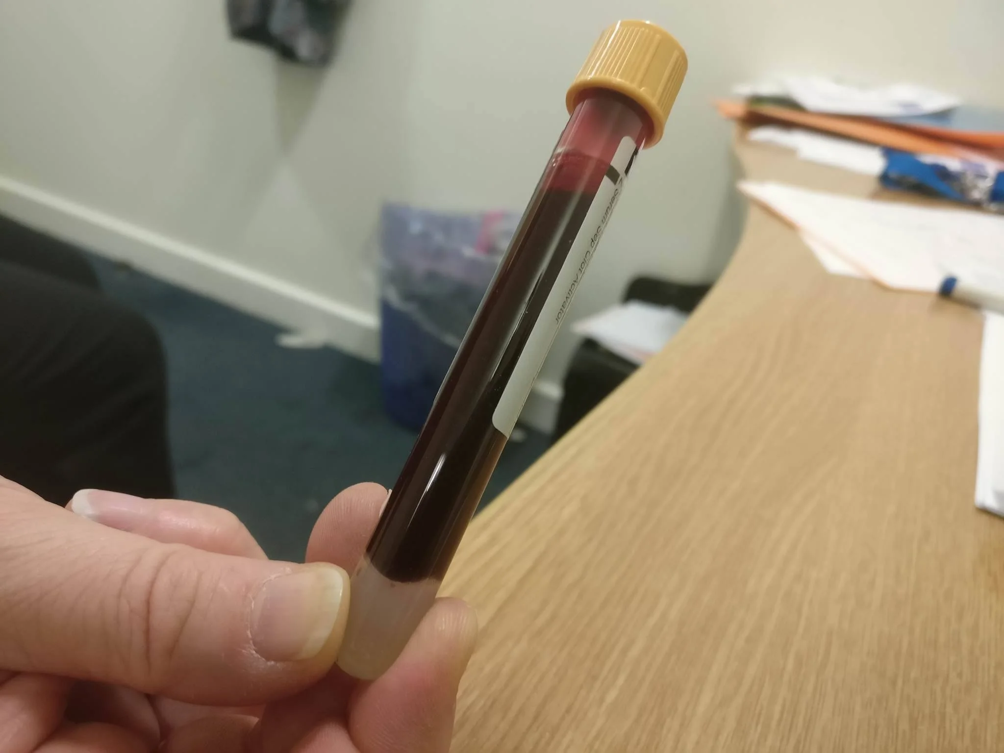 Ollie's Blood™ (home recipe).