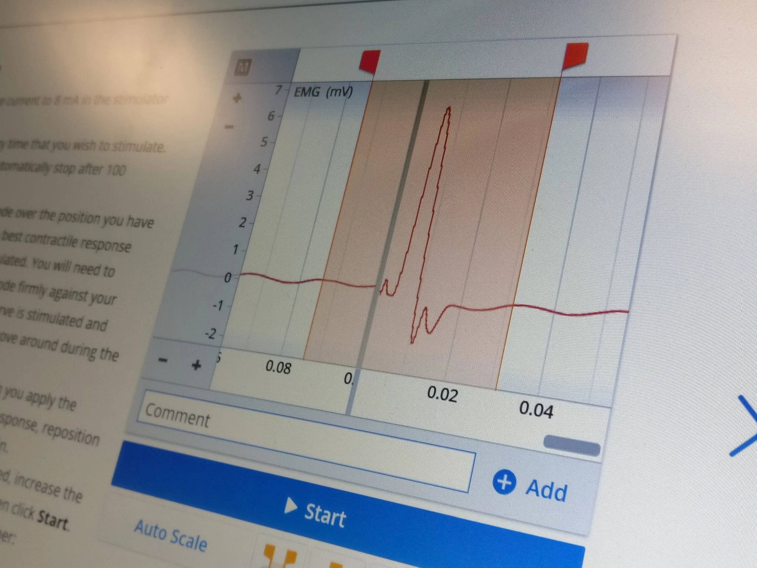 We were able to measure the electrical activity in the muscle when movement was elicited