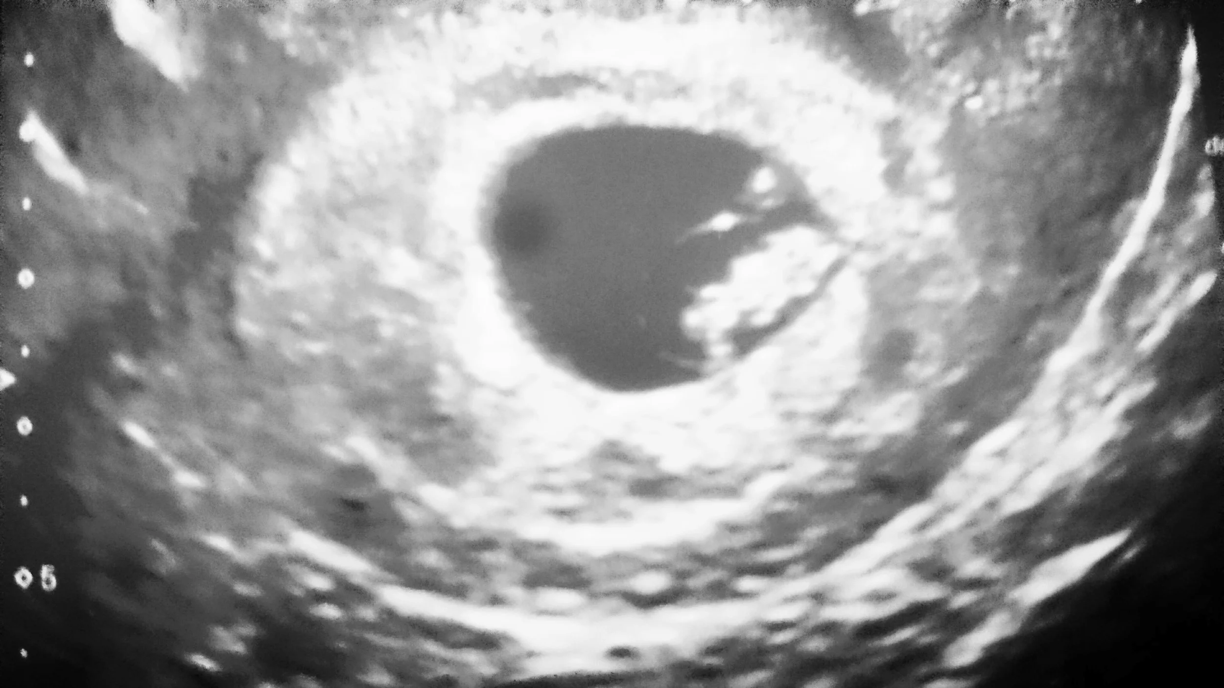 K.T.'s Story - London Health Sciences Centre, London