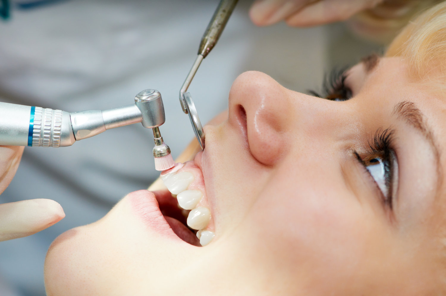 What is a Deep Cleaning? — AP Dental Arts - Dentist North Palm Beach