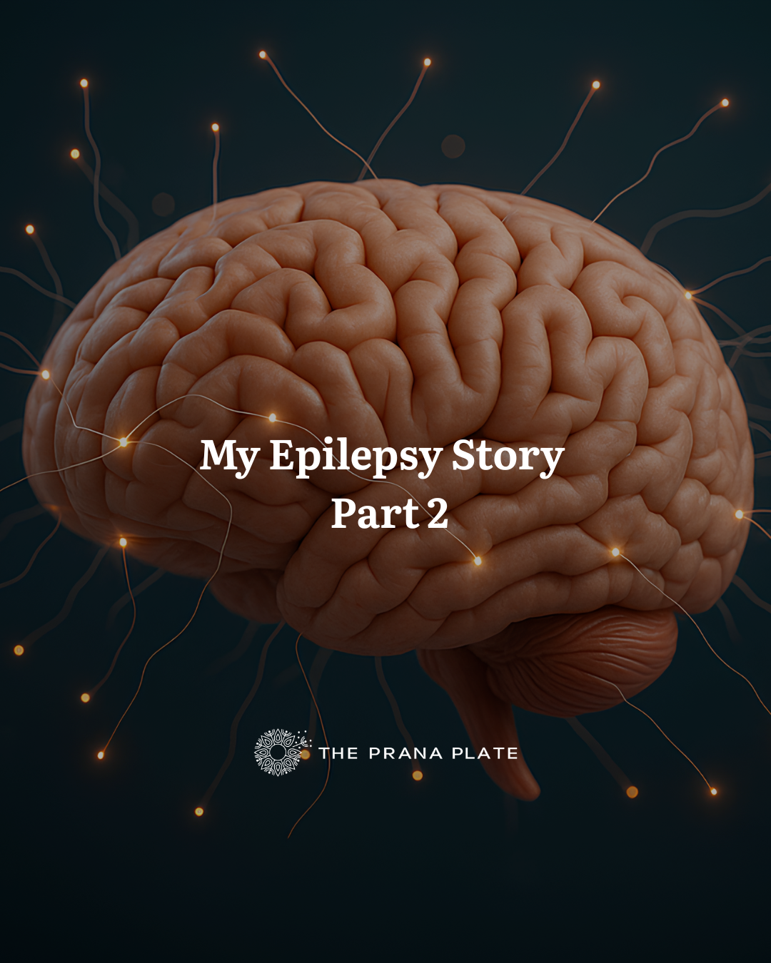 My Epilepsy Story - Part 2