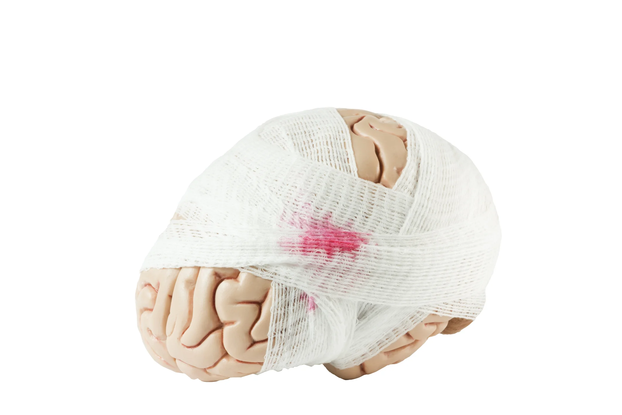 Falls in TBI Population