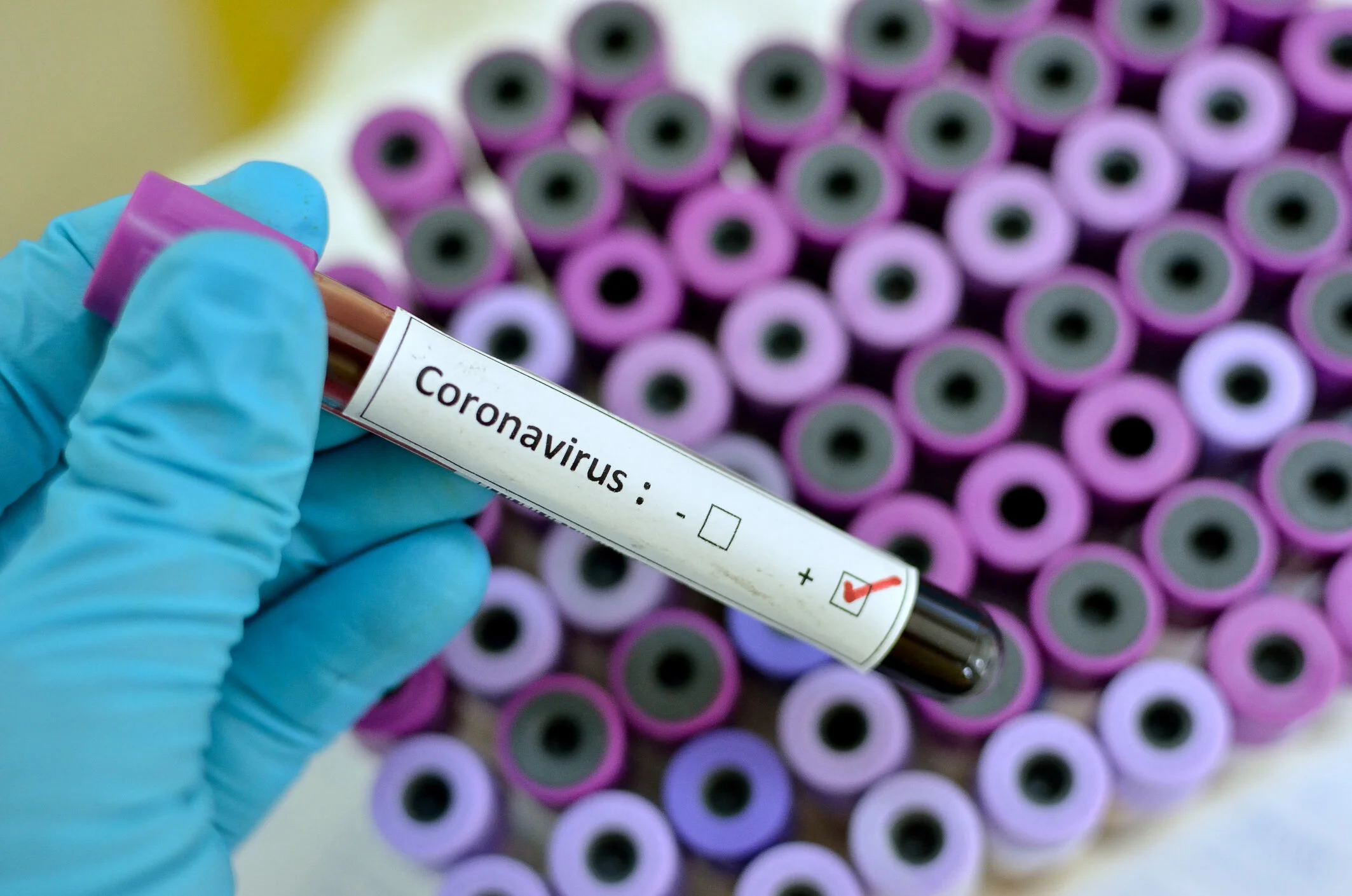 Coronavirus quarantine-how to stay healthy for older adults
