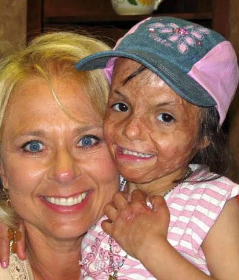 Teeba as a little girl.