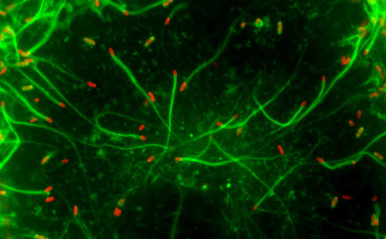   Rickettsia  (red) moving through host cells with long actin tails (green) 