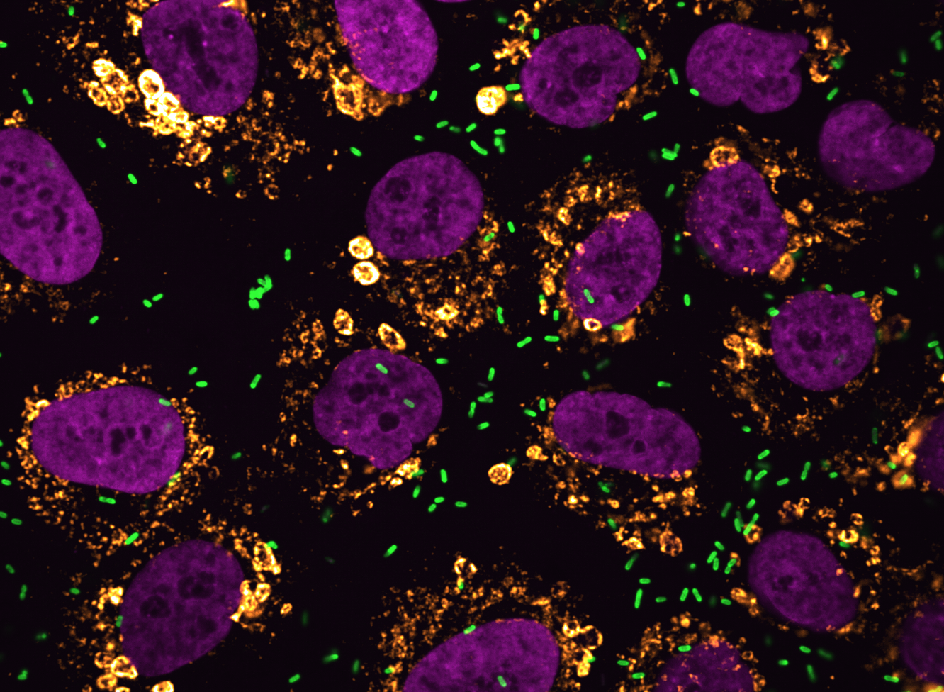   Rickettsia  (green) infected cells  - nuclei (purple) and mitochondria (gold) 