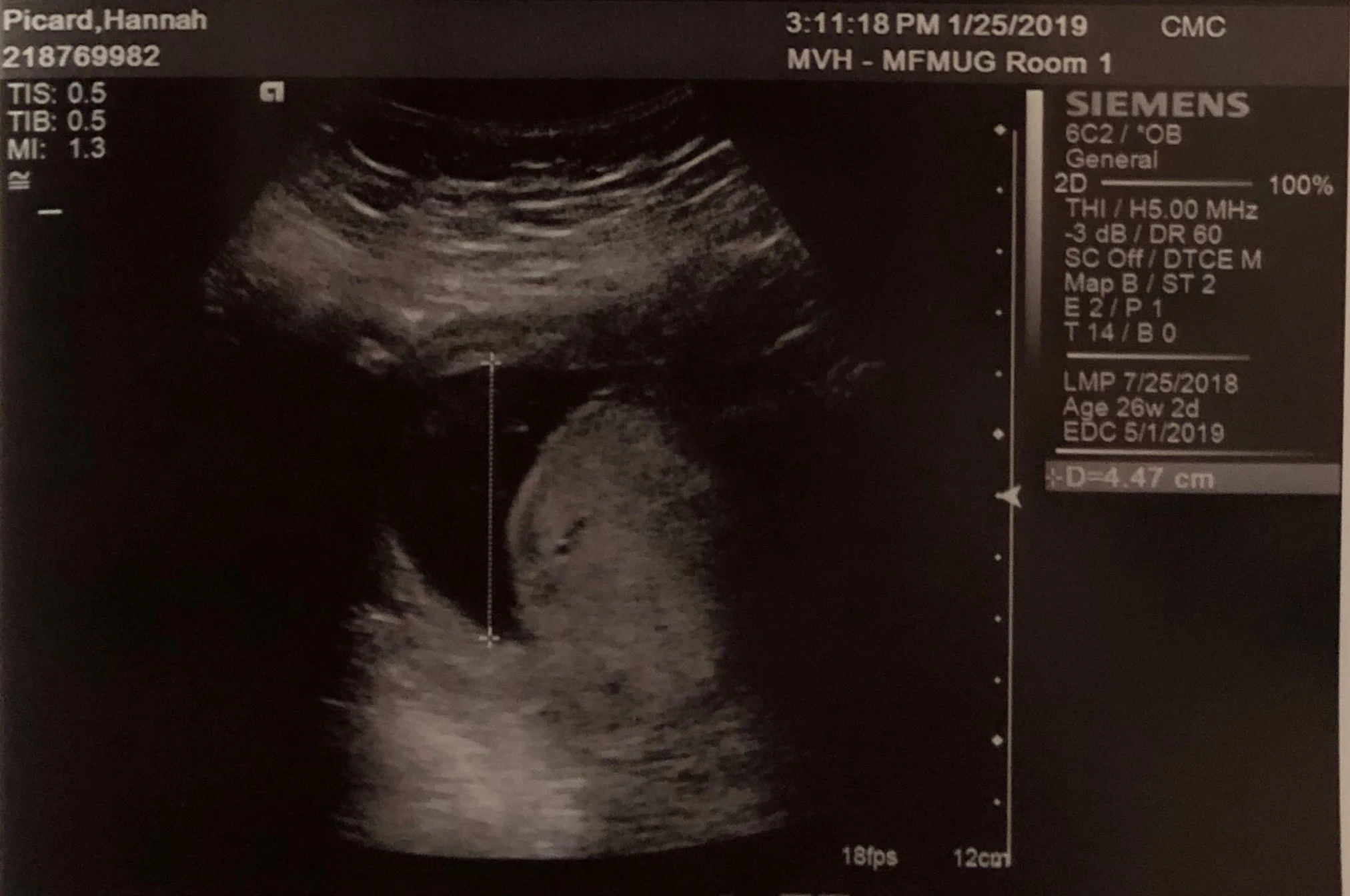 Weekly Ultrasound
