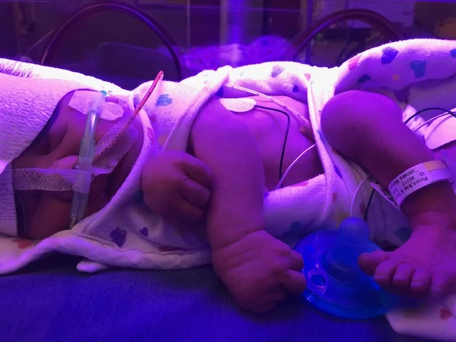 Jaundice light time. Normal for a preterm.