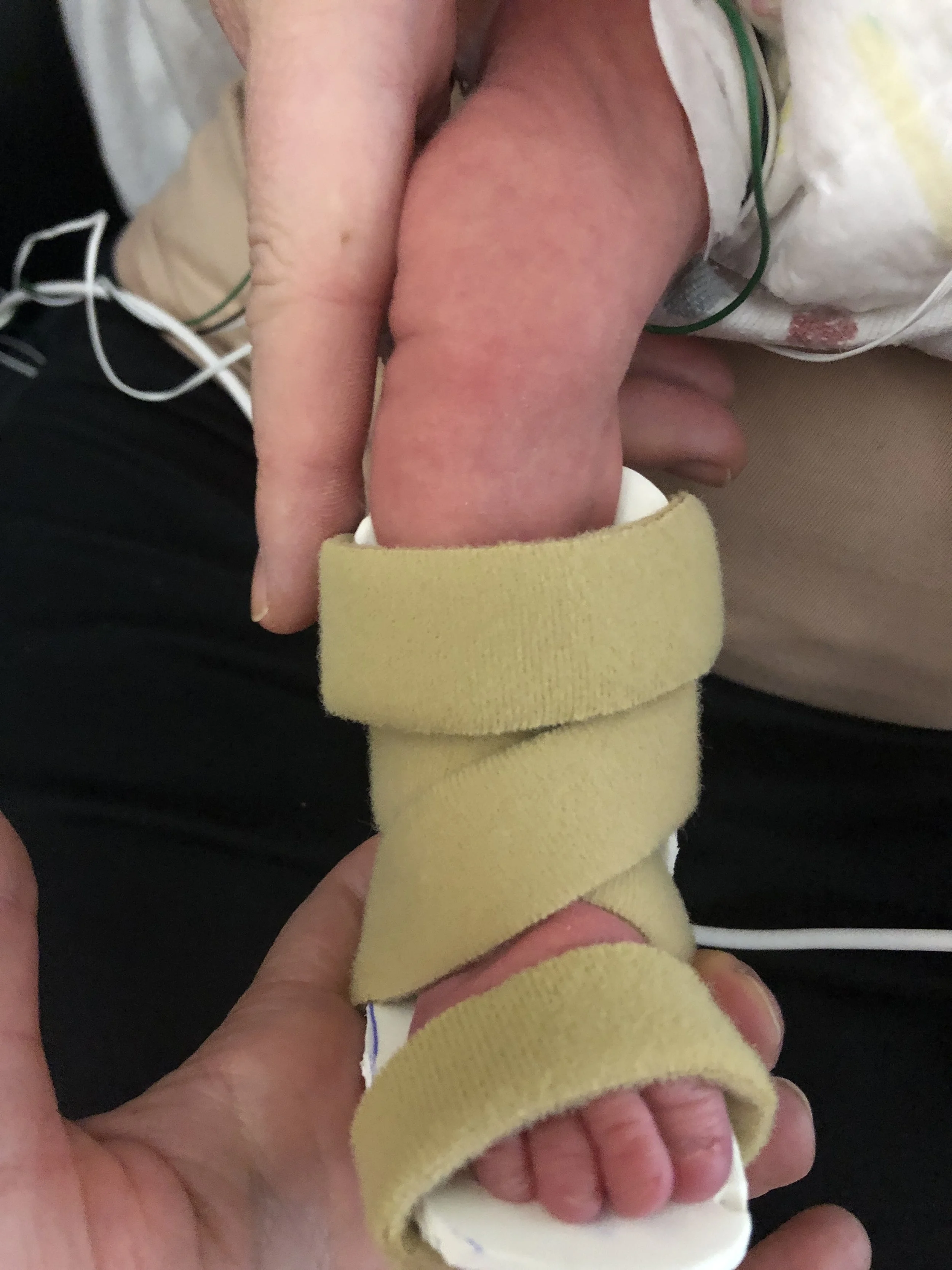 Lord, praise You for touching Asher’s little leg, foot, and hand in a miraculous way! We pray that every day his progress would amaze our OT team and he would never need a cast and nerve endings near his thumb would work exactly as You have created …