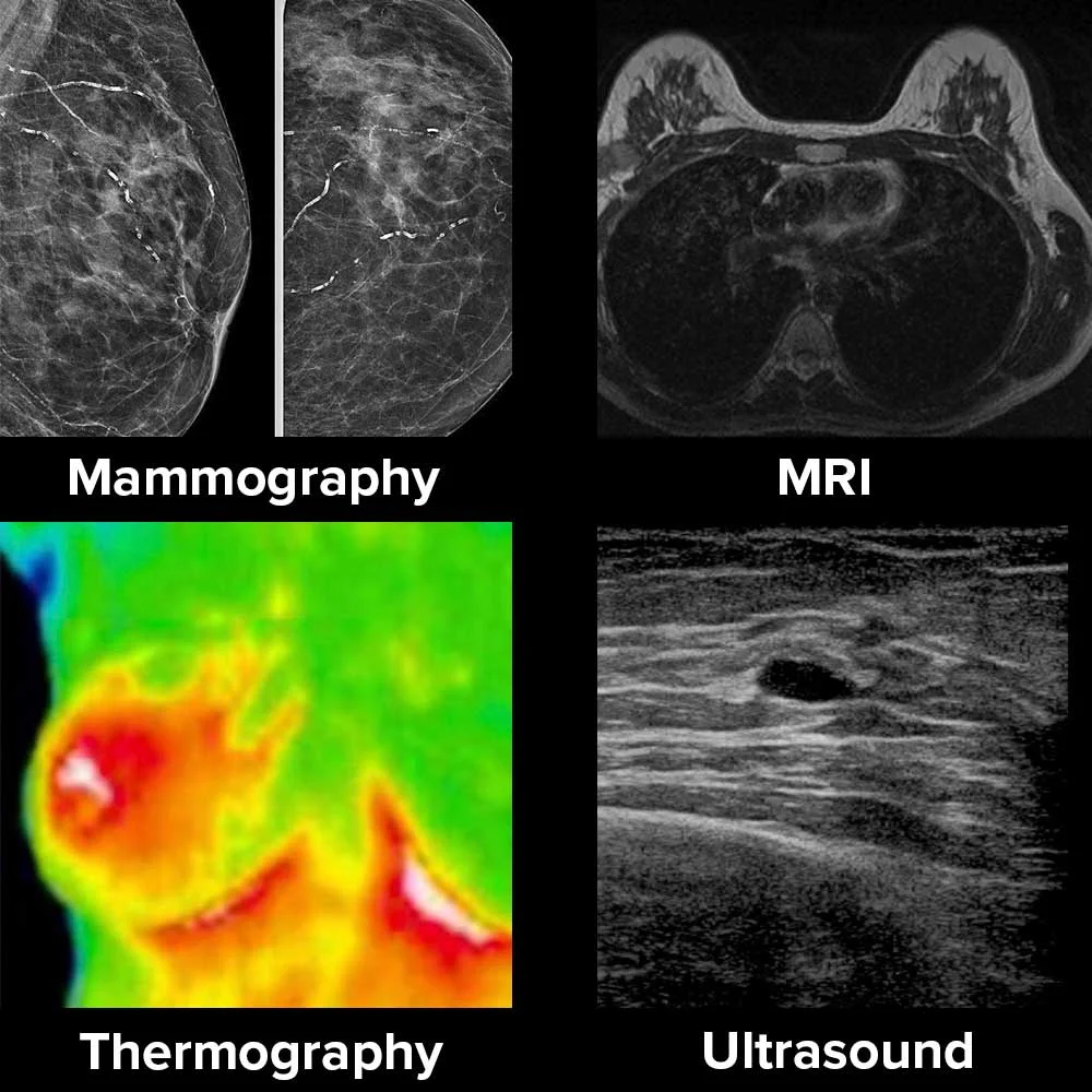 breast_imaging_examples_naturopathic_specialists.jpg