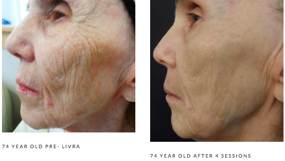 Photo Courtesy of our Growth Factor Serum Manufacturer
