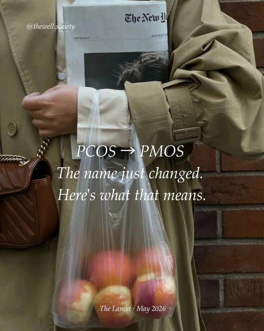 PCOS just became PMOS - and the one-letter change is bigger than it sounds. After more than a decade of global research, the condition has been formally renamed to reflect what it actually is: a complex hormonal and metabolic disorder. Not an ovarian