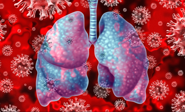 Contract law in the time of Corona