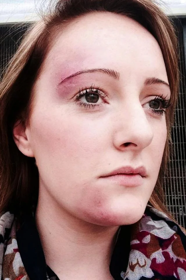 Bruises special effects make-up