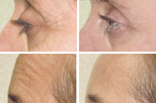 face1_closeup_0.jpg
