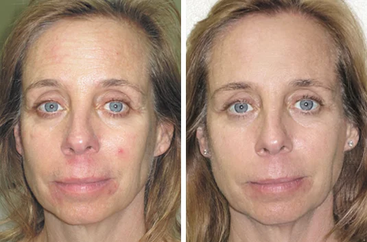 face1_front.jpg