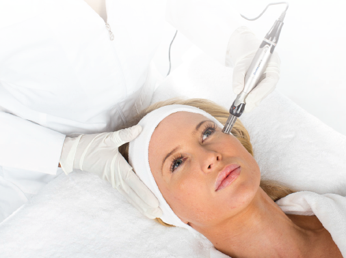 What is Collagen Induction Therapy?