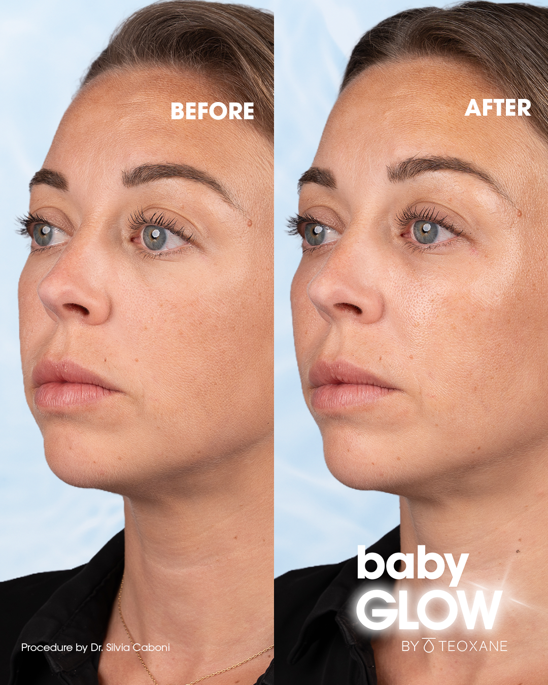 BABYGLOW_B&A_PRISCILLA_COUV.png