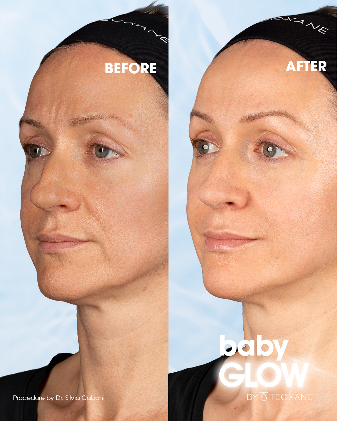 BABYGLOW_B&A_ALENA_COUV.png