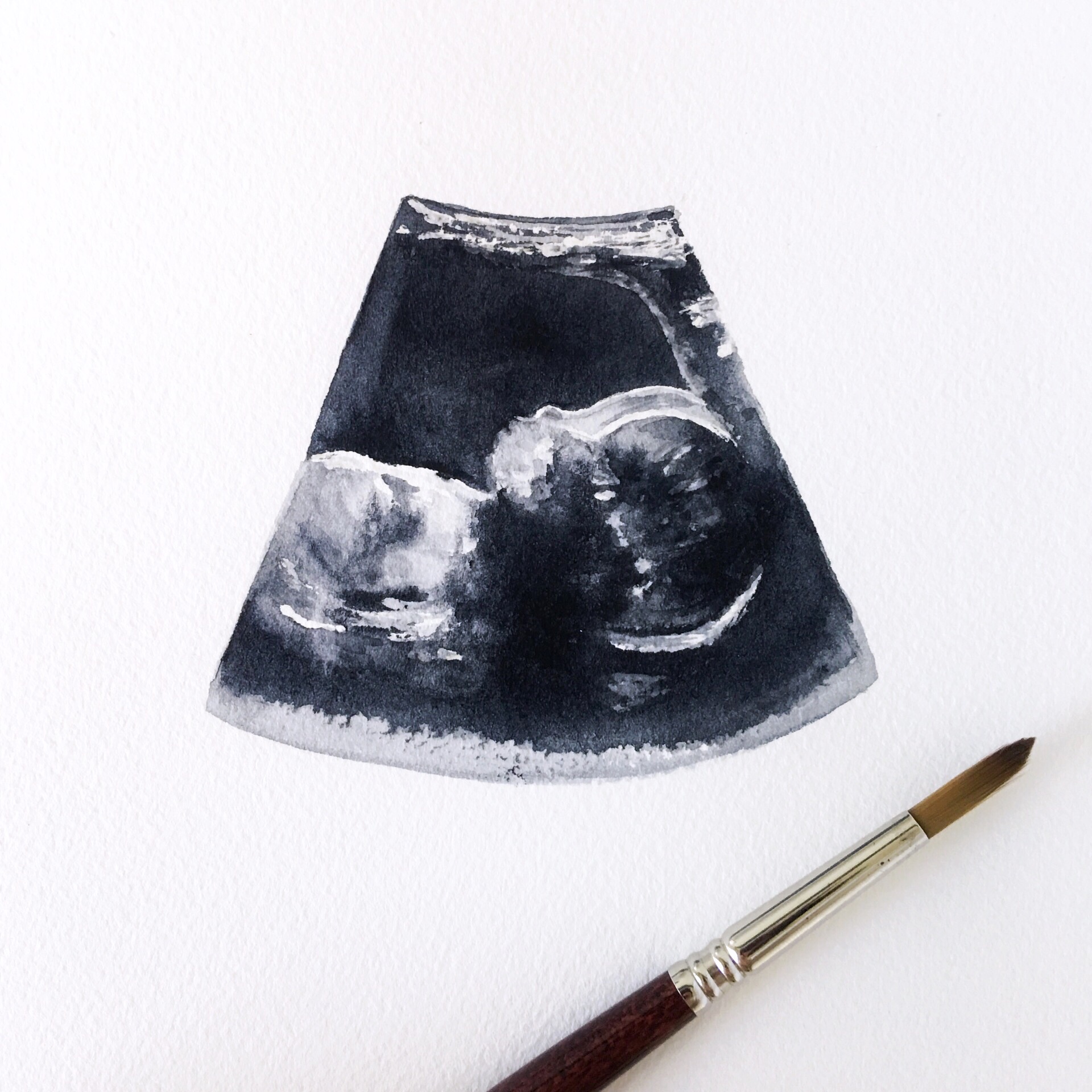 Ultrasound painting