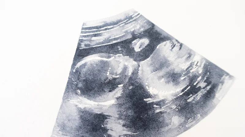 Ultrasound-Jessa-2.jpg
