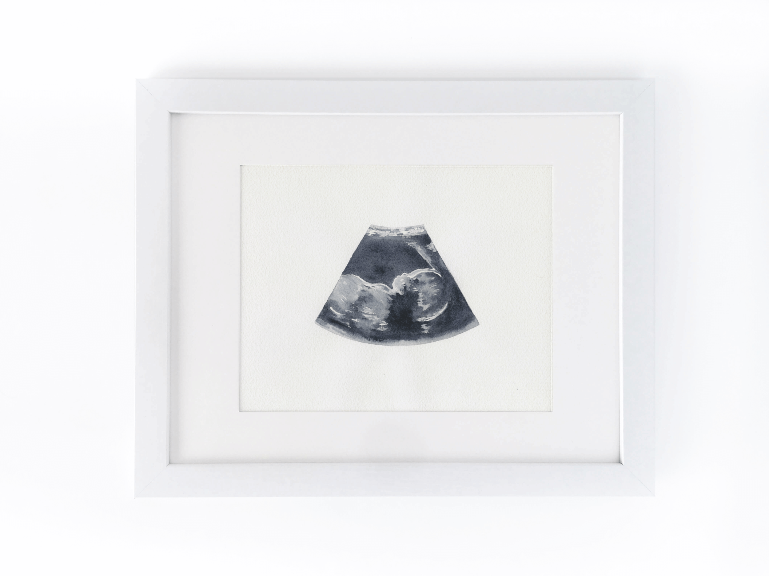 ultrasound mockup-frame.png