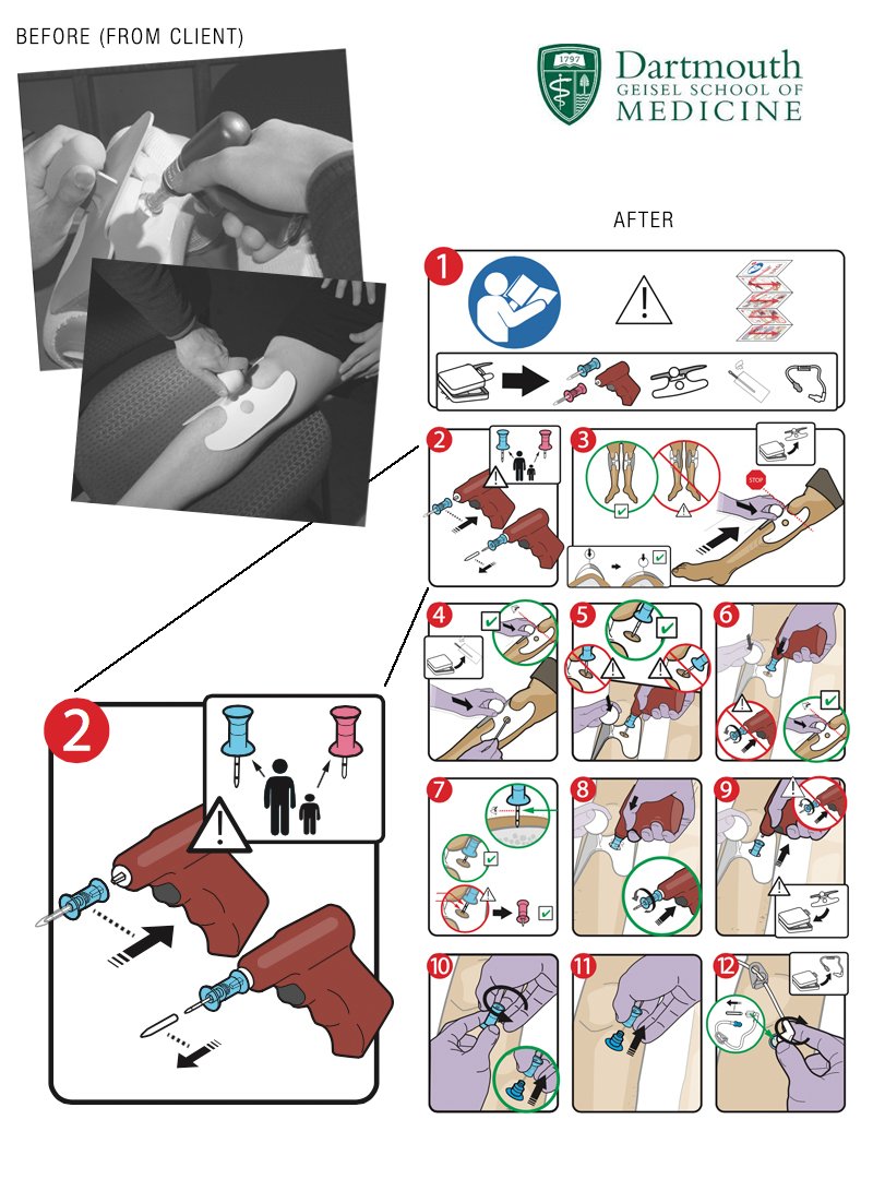 Medical Alignment Tool