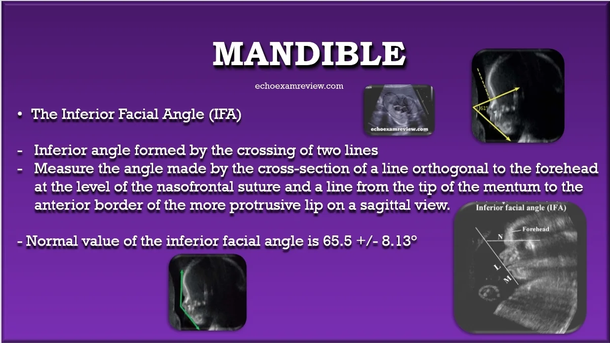Inferior Facial Angle (IFA)