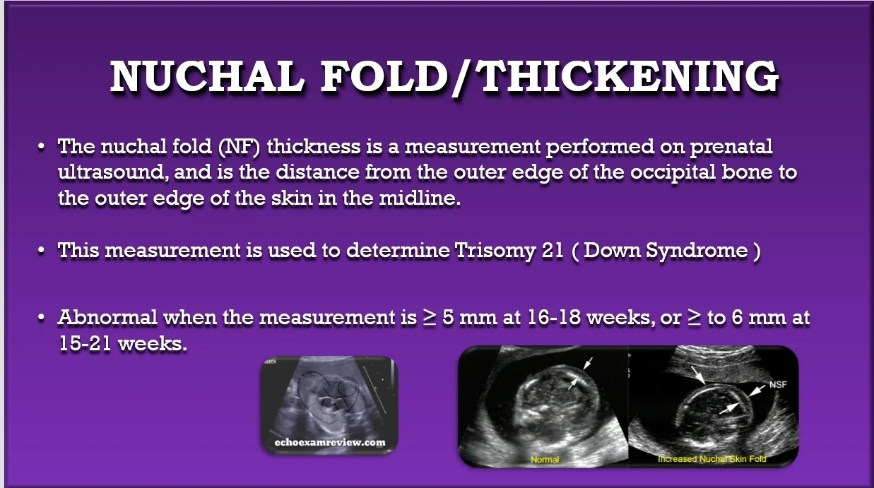 Nuchal Fold / Thickening