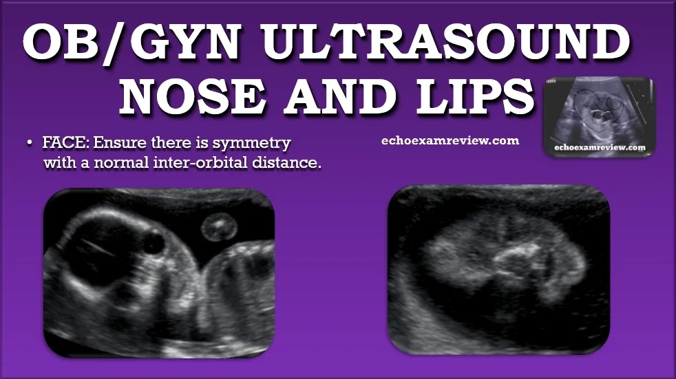 Ob Gyn Pictures