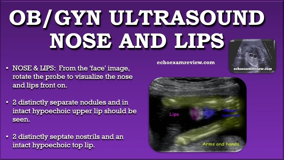 Ob Gyn Ultrasound Pictures